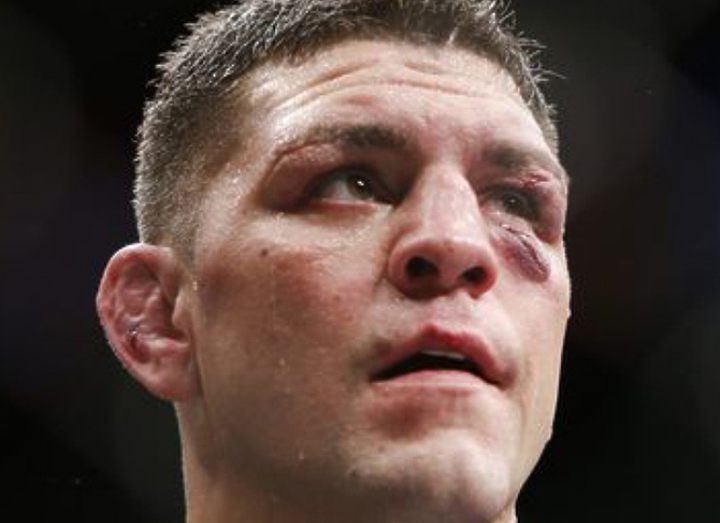 Ник Диаз дрался с травмированной рукой