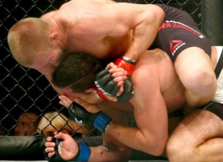 АЛЕСУ НИКОЛСОНУ ПОТРЕБУЕТСЯ ОПЕРАЦИЯ