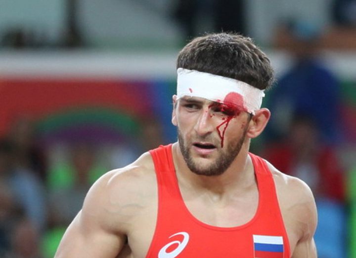 Аниуар Гедуев: говорил, что повязка перекрывает воздух, но иначе меня бы дисквалифицировали из-за рассечения