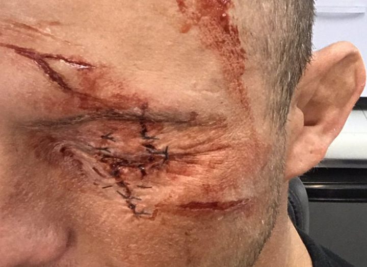 Ковбой шокировал фанатов жутким фото