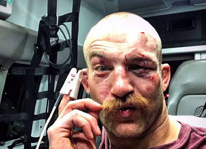 КАММИНС ПОСЛЕ БОЯ С БЛАХОВИЧЕМ