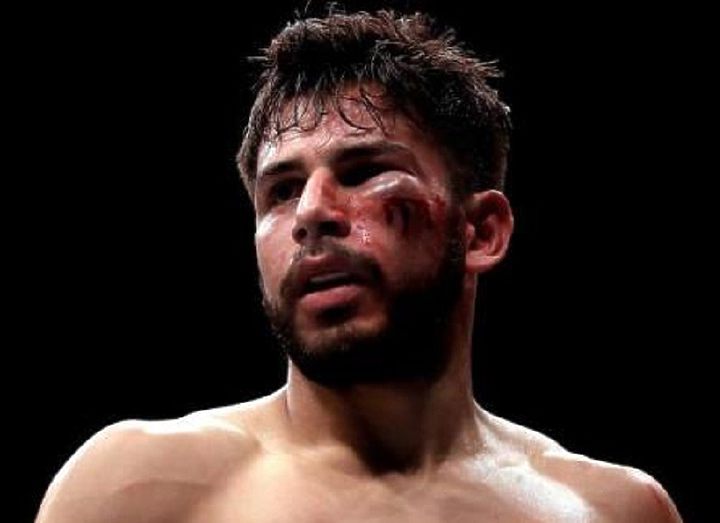 ЯИР РОДРИГЕС ПЛАНИРУЕТ ВЕРНУТЬСЯ ОСЕНЬЮ