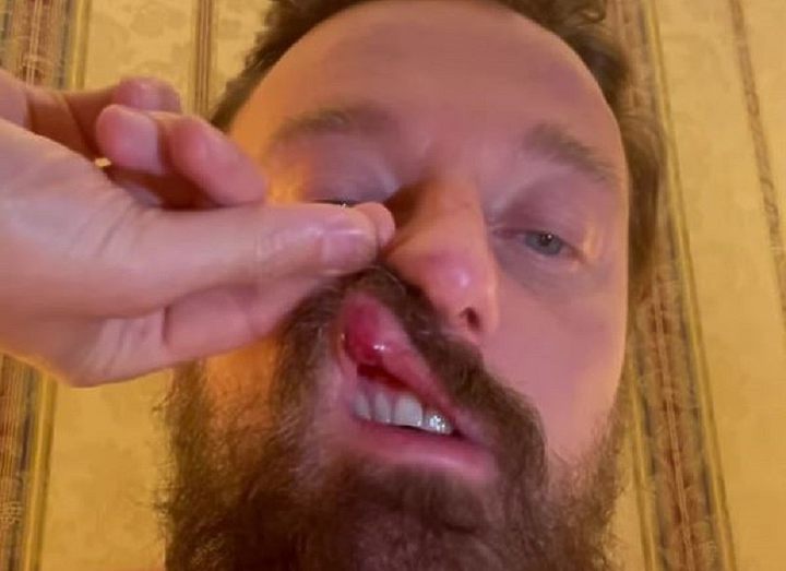 ИТАЛЬЯНСКИЙ ДИДЖЕЙ УТВЕРЖДАЕТ, ЧТО МАКГРЕГОР СЛОМАЛ ЕМУ НОС В КЛУБЕ