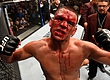 Нейт Диас: «Пусть в UFC молятся, что бы я снова не победил»